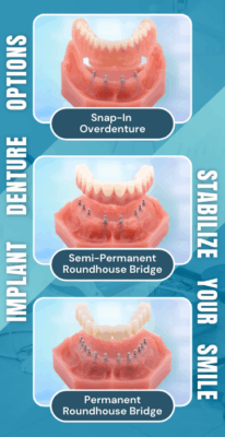 Implant Denture Options in Temecula, CA | Free Consultations To Secure Your Smile