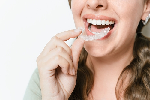 Invisalign in Temecula, CA | Free Consultations for Clear Aligners