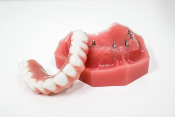 Mini Implant Dentures | Free Consultations in Temecula, CA