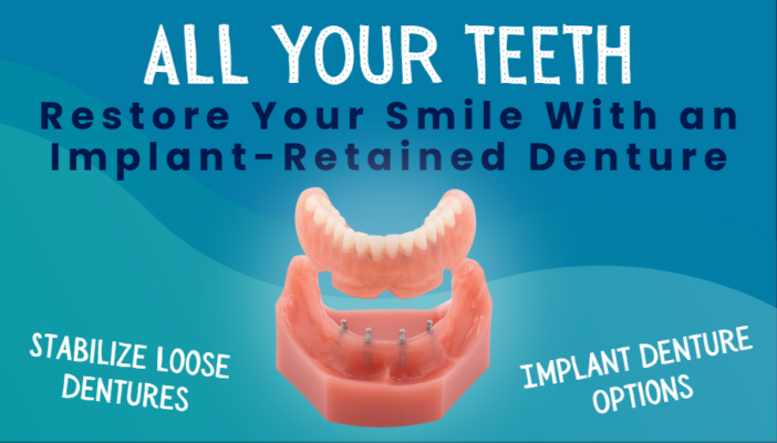 Implantes dentales de una sola pieza en Temcula, CA | Prótesis sobre implantes