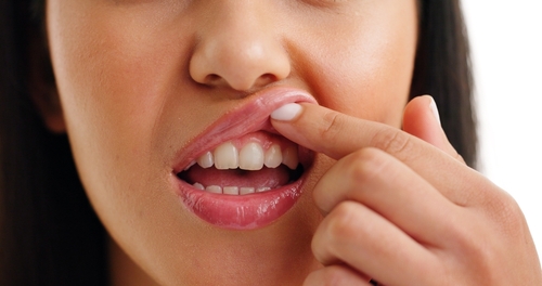 Reverse Gum Disease in Temecula, CA | Visit Us for Prompt Care!