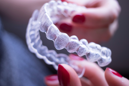 Braces Alternative in Temecula, CA | Book a Free Consultation